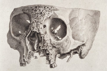 wellcomeimages154