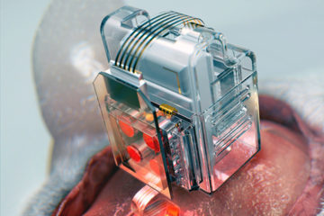 soft-neural-brain-implant-smartphone_dezeen_936_col_0