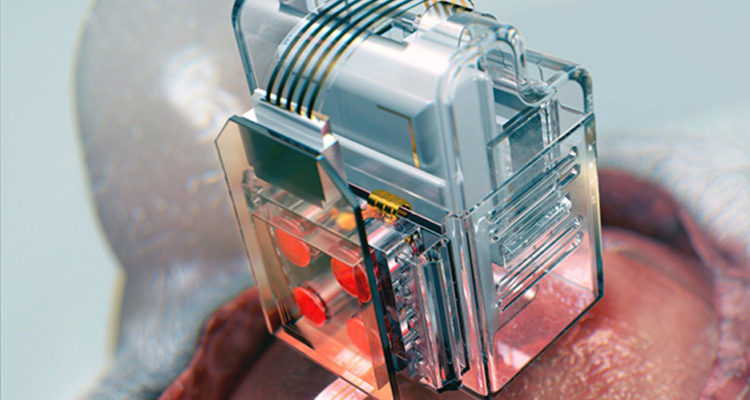 soft-neural-brain-implant-smartphone_dezeen_936_col_0